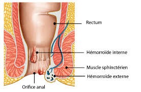 Anatomie des hémorroïdes